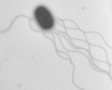 Salmonella Infantis im Elektronenmikroskop